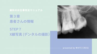 歯科のお仕事完全マニュアル　第３章　患者さんの情報　STEP７　X線写真（デンタルの撮影）