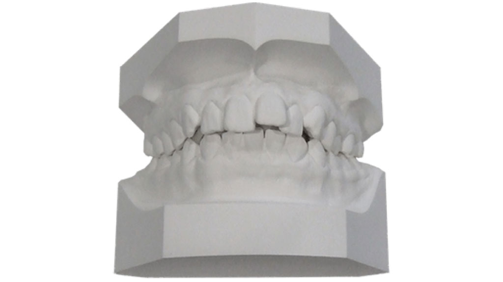 歯科のお仕事完全マニュアル 第５章 歯科技工とよく使用する材料