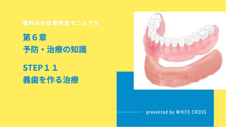 歯科のお仕事完全マニュアル 第６章 予防・治療の知識 STEP１１ 義歯を 