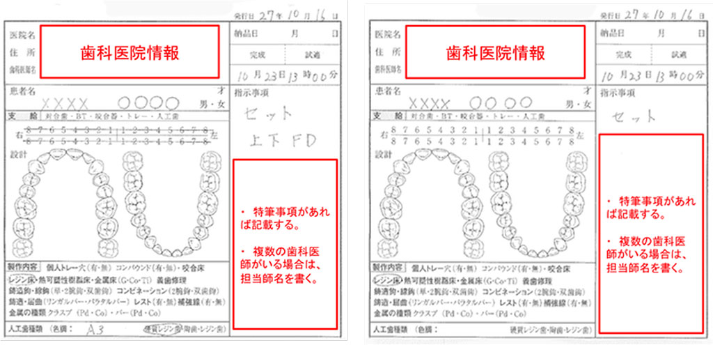技工指示書の記入例（義歯セット　左：上下FD　右：下顎PD）
