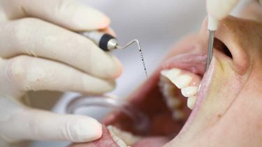 日本臨床歯周病学会認定歯科衛生士ってどんな資格？