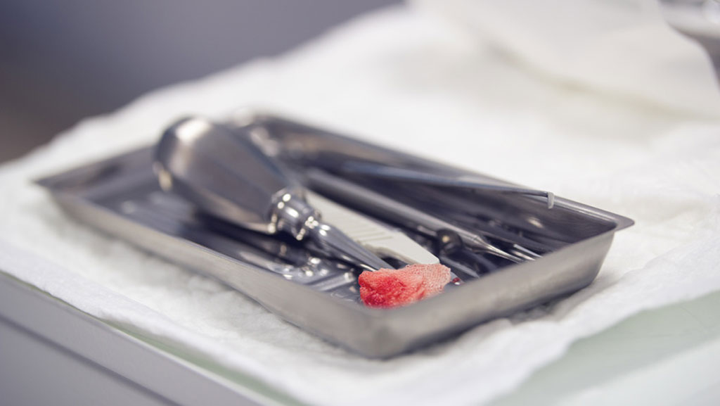血液や体液がついている器具をそのまま洗浄できる