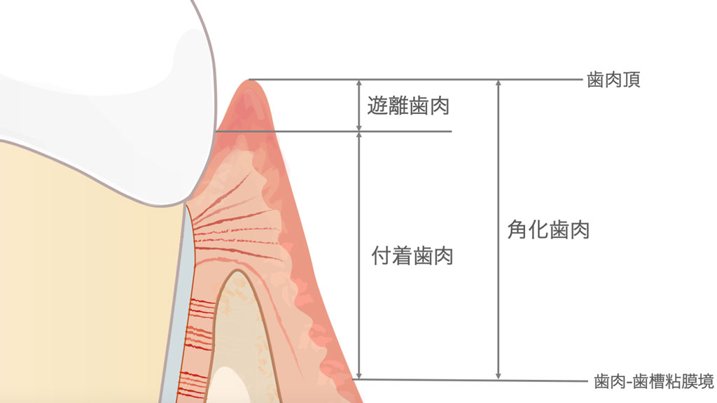 付着歯肉の幅（mm）=角化歯肉の幅（mm）-プロービング値（mm）