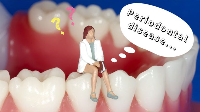 歯周病に関する分類をおさらいしよう！