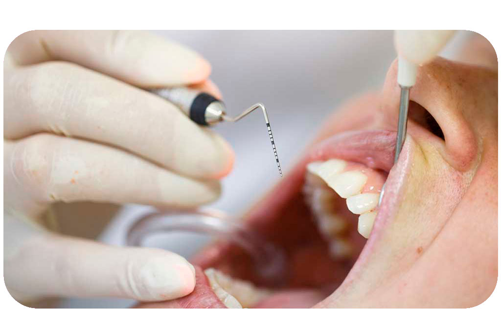 日本臨床歯周病学会認定歯科衛生士ってどんな資格？へ