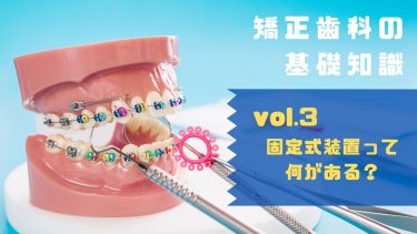 矯正歯科の基礎知識 vol.3 固定式装置って何がある？