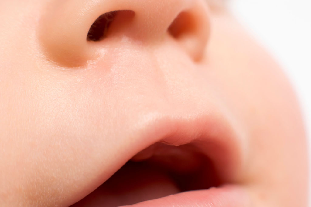 赤ちゃんの口は口蓋の中央が高くなっている