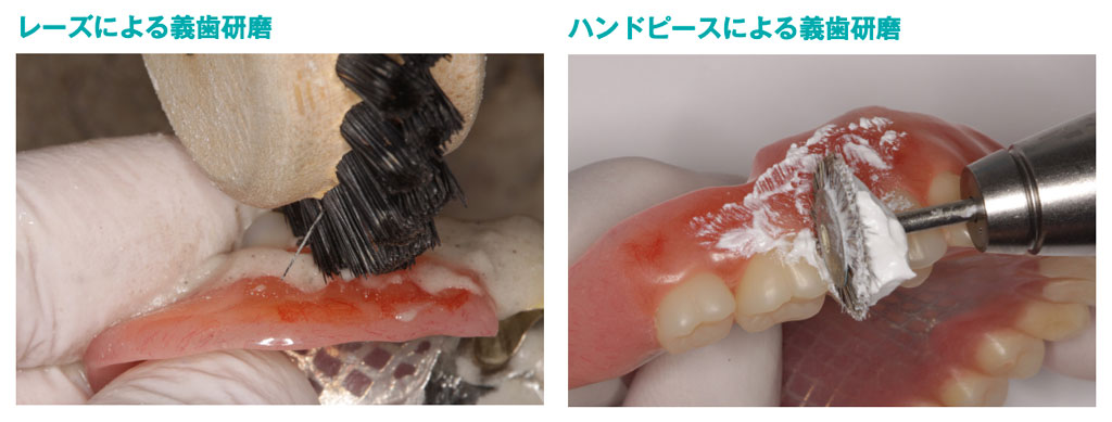 義歯研磨にはデンチャープラークの付着を防ぐ効果もある（提供：デンチャーメインテナンス，デンタルダイヤモンド社，2017，86p．）