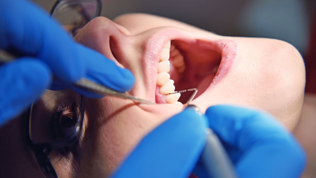 歯周病部分的再評価検査