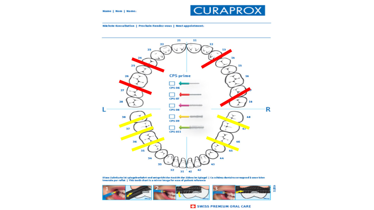 CURAPROX歯間ブラシのチャート用紙