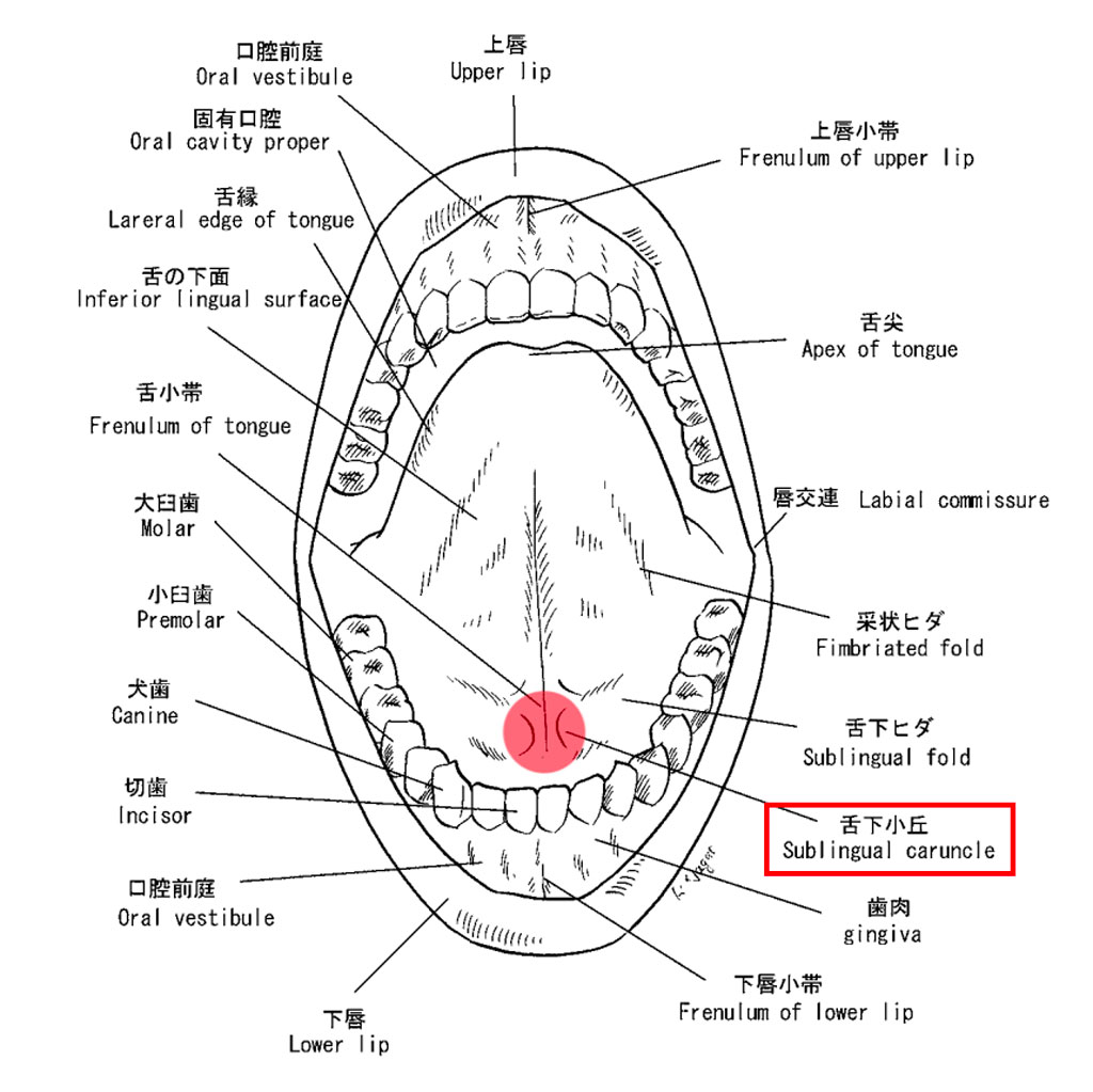 日本口腔腫瘍学会学術委員会「舌癌取扱い指針」 臨床解剖学的な図譜（5.口腔底）を元に編集
