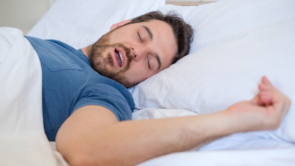 閉塞性睡眠時無呼吸症候群（OSA）